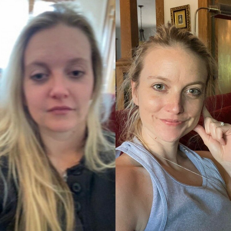 Пользовательница с ником picklesarelife1, отказавшись от алкоголя, показала на Reddit, как изменилась ее внешность за три года. Ее публикация собрала свыше 40 тысяч лайков.-2